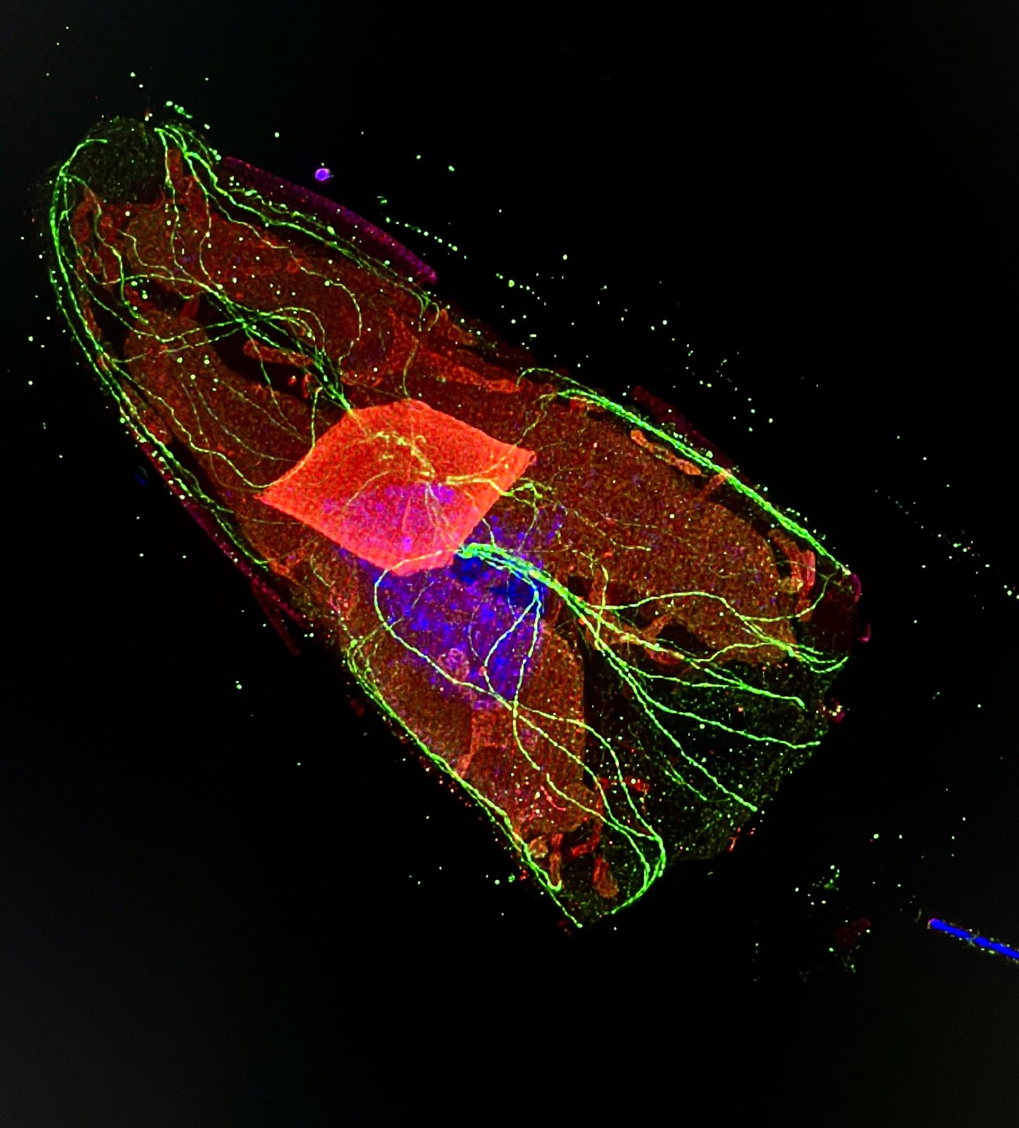 James visits Basel to learn expansion microscopy
