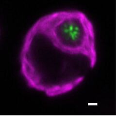 Bestrophin-like protein 4 involved in photosynthetic acclimation to light fluctuations in Chlamydomonas