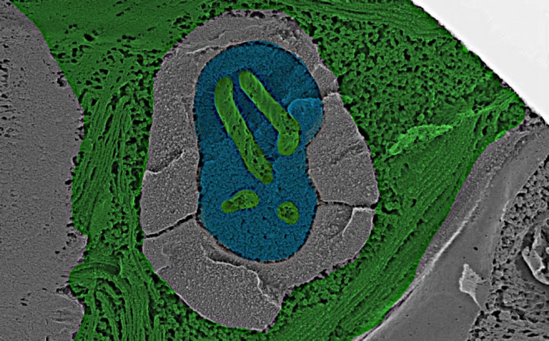 Coloured electron micrograph of a Chlamydomonas pyrenoid